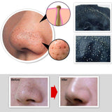 Deep Cleansing Blackhead Removal Facial Mask